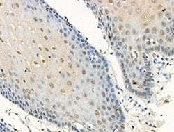 Invitrogen Phospho-Progesterone Receptor (Ser190) Polyclonal Antibody 100