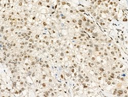 Invitrogen Phospho-Progesterone Receptor (Ser190) Polyclonal Antibody 100