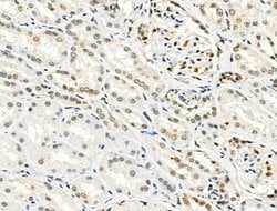Invitrogen Phospho-Progesterone Receptor (Ser190) Polyclonal Antibody 100