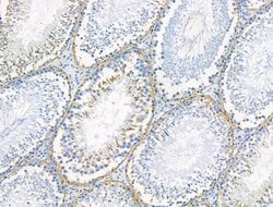 Phospho-PSD-95 (Ser418) Polyclonal Antibody:Antibodies, Polyclonal