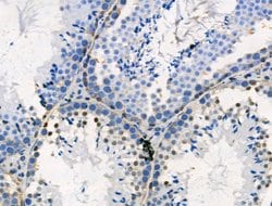 Phospho-PSD-95 (Ser418) Polyclonal Antibody:Antibodies, Polyclonal