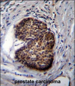 Invitrogen PSCA Polyclonal Antibody 400 &mu;L; Unconjugated:Antibodies,