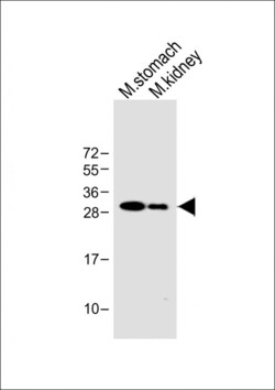Invitrogen PSCA Polyclonal Antibody 400 &mu;L; Unconjugated:Antibodies,