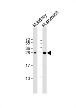 Invitrogen PSCA Polyclonal Antibody 400 &mu;L; Unconjugated:Antibodies,