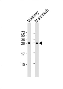 Invitrogen PSCA Polyclonal Antibody 400 &mu;L; Unconjugated:Antibodies,