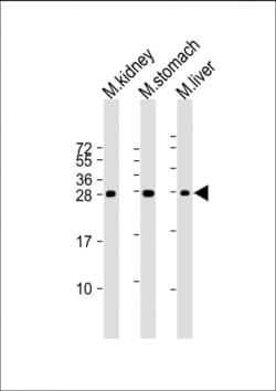 Invitrogen PSCA Polyclonal Antibody 400 &mu;L; Unconjugated:Antibodies,