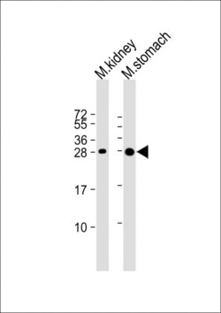 Invitrogen PSCA Polyclonal Antibody 400 &mu;L; Unconjugated:Antibodies,