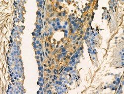 Invitrogen Phospho-RAB29 (Ser72) Polyclonal Antibody 100 &mu;L; Unconjugated:Antibodies,