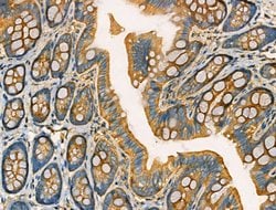 Invitrogen Phospho-RAB29 (Ser72) Polyclonal Antibody 100 &mu;L; Unconjugated:Antibodies,