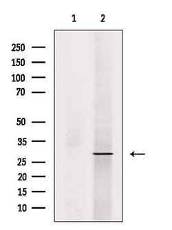 Invitrogen Phospho-RAB29 (Ser72) Polyclonal Antibody 100 &mu;L; Unconjugated:Antibodies,