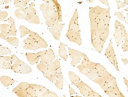 Invitrogen Phospho-RB1 (Ser780) Polyclonal Antibody 100 &mu;L; Unconjugated:Antibodies,