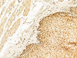 Invitrogen Phospho-RB1 (Ser780) Polyclonal Antibody 100 &mu;L; Unconjugated:Antibodies,