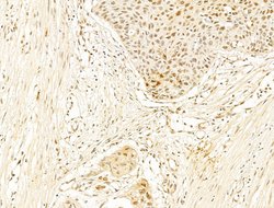 Invitrogen Phospho-RB1 (Ser780) Polyclonal Antibody 100 &mu;L; Unconjugated:Antibodies,