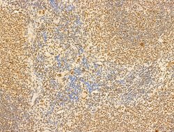 Invitrogen Phospho-RB1 (Ser780) Polyclonal Antibody 100 &mu;L; Unconjugated:Antibodies,