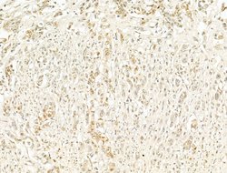 Invitrogen Phospho-RB1 (Ser780) Polyclonal Antibody 100 &mu;L; Unconjugated:Antibodies,