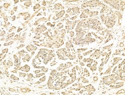 Invitrogen Phospho-RB1 (Ser780) Polyclonal Antibody 100 &mu;L; Unconjugated:Antibodies,