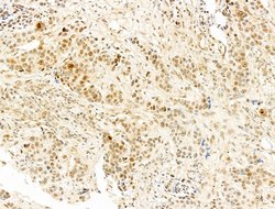 Invitrogen Phospho-RB1 (Ser780) Polyclonal Antibody 100 &mu;L; Unconjugated:Antibodies,