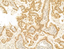 Invitrogen Phospho-RB1 (Ser780) Polyclonal Antibody 100 &mu;L; Unconjugated:Antibodies,