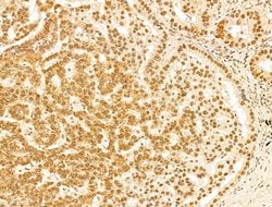 Invitrogen Phospho-RB1 (Ser780) Polyclonal Antibody 100 &mu;L; Unconjugated:Antibodies,