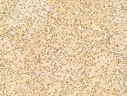 Invitrogen Phospho-RB1 (Ser780) Polyclonal Antibody 100 &mu;L; Unconjugated:Antibodies,