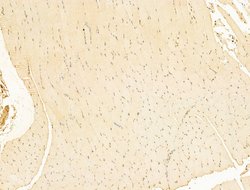 Invitrogen Phospho-RB1 (Ser780) Polyclonal Antibody 100 &mu;L; Unconjugated:Antibodies,