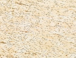 Invitrogen Phospho-RB1 (Ser780) Polyclonal Antibody 100 &mu;L; Unconjugated:Antibodies,