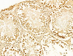 Invitrogen Phospho-RB1 (Ser780) Polyclonal Antibody 100 &mu;L; Unconjugated:Antibodies,