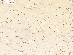 Invitrogen Phospho-RB1 (Ser780) Polyclonal Antibody 100 &mu;L; Unconjugated:Antibodies,