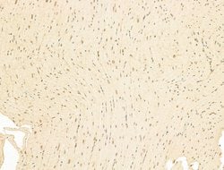 Invitrogen Phospho-RB1 (Ser780) Polyclonal Antibody 100 &mu;L; Unconjugated:Antibodies,