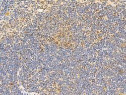 Invitrogen Phospho-RB1 (Ser780) Polyclonal Antibody 100 &mu;L; Unconjugated:Antibodies,