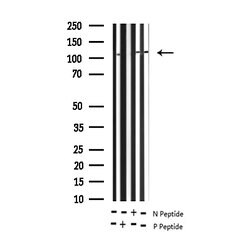 Invitrogen Phospho-RB1 (Ser780) Polyclonal Antibody 100 &mu;L; Unconjugated:Antibodies,