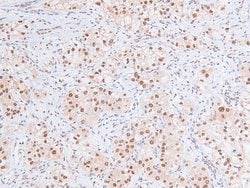 Invitrogen Phospho-RB1 (Ser788) Polyclonal Antibody 100 &mu;L; Unconjugated:Antibodies,