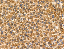 Invitrogen Phospho-ROCK1 (Thr455, Ser456) Polyclonal Antibody 100 &mu;L;