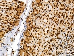 Invitrogen Phospho-RSK Pan (Ser221, Ser227, Ser218, Ser232) Polyclonal