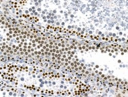 Invitrogen Phospho-RSK Pan (Ser221, Ser227, Ser218, Ser232) Polyclonal