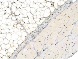 Invitrogen Phospho-RSK Pan (Ser221, Ser227, Ser218, Ser232) Polyclonal