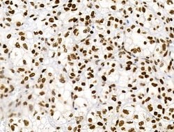 Invitrogen Phospho-RSK Pan (Ser221, Ser227, Ser218, Ser232) Polyclonal