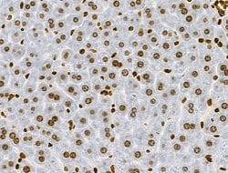 Invitrogen Phospho-RSK Pan (Ser221, Ser227, Ser218, Ser232) Polyclonal