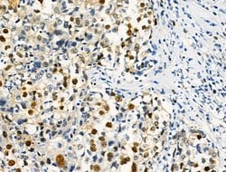 Invitrogen Phospho-SAMHD1 (Thr592) Polyclonal Antibody 100 &mu;L; Unconjugated:Antibodies,