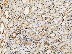 Invitrogen Phospho-SAMHD1 (Thr592) Polyclonal Antibody 100 &mu;L; Unconjugated:Antibodies,