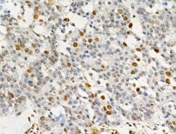 Invitrogen Phospho-SAMHD1 (Thr592) Polyclonal Antibody 100 &mu;L; Unconjugated:Antibodies,