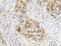 Invitrogen Phospho-SAMHD1 (Thr592) Polyclonal Antibody 100 &mu;L; Unconjugated:Antibodies,