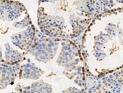 Invitrogen Phospho-SAMHD1 (Thr592) Polyclonal Antibody 100 &mu;L; Unconjugated:Antibodies,