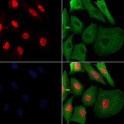 Invitrogen Phospho-SAMHD1 (Thr592) Polyclonal Antibody 100 &mu;L; Unconjugated:Antibodies,