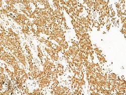 Invitrogen Phospho-SHP2 (Tyr580) Polyclonal Antibody 100 &mu;L; Unconjugated:Antibodies,