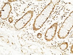 Invitrogen Phospho-SHP2 (Tyr580) Polyclonal Antibody 100 &mu;L; Unconjugated:Antibodies,