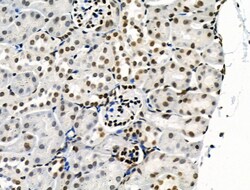 Invitrogen Phospho-SRPK2 (Thr492) Polyclonal Antibody 100 &mu;L; Unconjugated:Antibodies,
