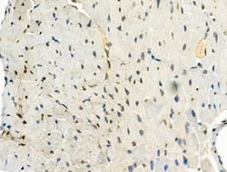 Invitrogen Phospho-SRPK2 (Thr492) Polyclonal Antibody 100 &mu;L; Unconjugated:Antibodies,