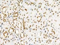 Invitrogen Phospho-SRPK2 (Thr492) Polyclonal Antibody 100 &mu;L; Unconjugated:Antibodies,