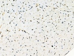 Invitrogen Phospho-TAOK2 (Ser181) Polyclonal Antibody 100 &mu;L; Unconjugated:Antibodies,